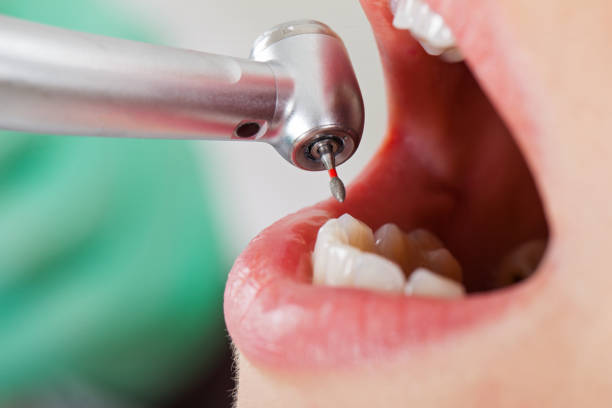 Best Emergency Dental Care for Sports Injuries in Greenville, DE